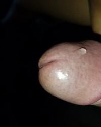 photo-thumb