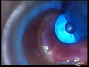 Endoscope POV: Test Tube Cock Urethral Insertion